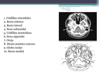 1. Celdillas etmoidales 
2. Recto inferior 
3. Recto lateral 
4. Seno esfenoidal 
5. Celdillas mastoideas 
6. Seno sigmoide 
7. Oreja 
8. Meato acústico externo 
9. Globo ocular 
10. Recto medial 
10010337- ALVAREZ 
CASTRO, Miguel 
Eduardo 
 
