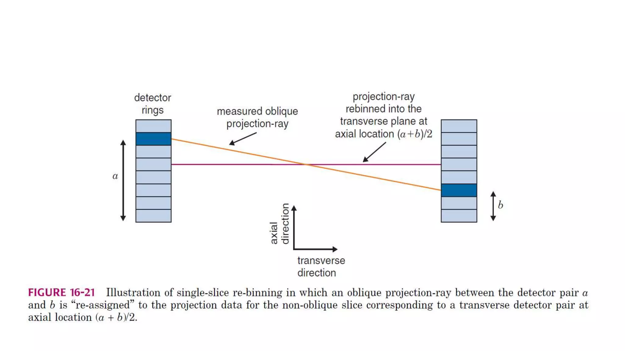 Tomographic reconstruction in nuclear medicine | PPTX