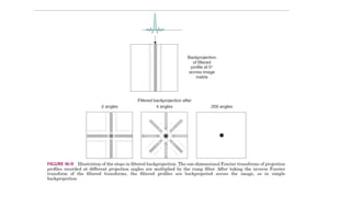 Tomographic reconstruction in nuclear medicine | PPTX