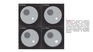 Tomographic reconstruction in nuclear medicine | PPTX