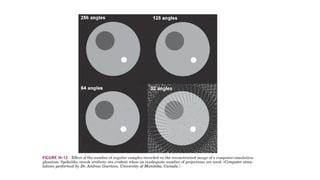 Tomographic reconstruction in nuclear medicine | PPTX