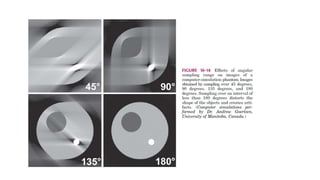 Tomographic reconstruction in nuclear medicine | PPTX