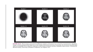 Tomographic reconstruction in nuclear medicine | PPTX