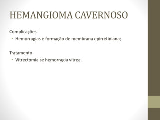 HEMANGIOMA CAVERNOSO
Complicações
• Hemorragias e formação de membrana epirretiniana;
Tratamento
• Vitrectomia se hemorragia vítrea.
 