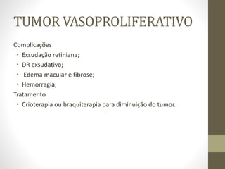 TUMOR VASOPROLIFERATIVO
Complicações
• Exsudação retiniana;
• DR exsudativo;
• Edema macular e fibrose;
• Hemorragia;
Tratamento
• Crioterapia ou braquiterapia para diminuição do tumor.
 