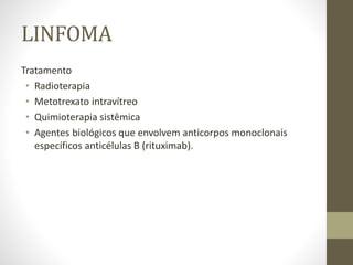 LINFOMA
Tratamento
• Radioterapia
• Metotrexato intravítreo
• Quimioterapia sistêmica
• Agentes biológicos que envolvem anticorpos monoclonais
específicos anticélulas B (rituximab).
 