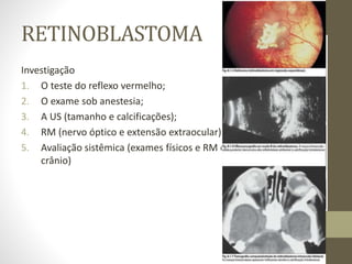 RETINOBLASTOMA
Investigação
1. O teste do reflexo vermelho;
2. O exame sob anestesia;
3. A US (tamanho e calcificações);
4. RM (nervo óptico e extensão extraocular)
5. Avaliação sistêmica (exames físicos e RM de órbita e do
crânio)
 