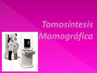 Tomosíntesis
Mamográfica
 
