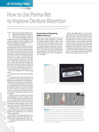 LMT • August 2015 • www.LMTmag.com 34
How to Use Perma-Ret
to Improve Denture Retention
T
oday’s nano-composite, highly cross-
linked and hybrid denture teeth con-
tinually pose a retention problem in
cases with limited space once the
bondable lingual layer of PMMA has been
removed. Implant treatment modalities with
their rigid foundation and opposition exacer-
bate these compromised bonds.
To solve the problem, technicians often use
bonding primers, diatoric retention or slot the
lingual but I’ve discovered a better solution:
Perma-Ret, a pin retention system from Preat
Corp. The kit includes twist drills, a drill and
wire holder, collets and 80mm-long threaded
silver wire (see Figure 1). Similar to the way
metal pins are used to retain porcelain den-
ture teeth, the Perma-Ret wire is threaded
into a drilled hole in the denture teeth; the
wire is small and unobtrusive and provides
mechanical retention between the teeth and
the acrylic base. The placement technique is
easy to master and the kit pays for itself by
preventing repairs on warrantied dentures.
Here’s my technique; this is done during
setup:
1. Adjust the teeth to fit into the allowable
space.
2. Using the twist drill, drill a hole into
each tooth at a suitable angle and position as
dictated by the remaining acrylic and the hori-
zontal space before intrusion or perforation.
When I first started learning to use Perma-
Ret, I marked the drill bit with a magic marker
to indicate the depth of the hole and continue
to use this mark as a reference (see Figure
2). Preat recommends a 3mm depth but I’ve
drilled to only 1mm depth without any failure
in retention.
Using the mark on the drill bit, mark the
coinciding depth on the wire and place it into
the wire holder; expose only a short length of
wire so you don’t bend it. Thread the wire into
the hole in the tooth; you’ll feel a fair amount
of resistance while threading and your mark
ensures the wire hasn’t “bottomed out” which
can damage the tooth or wire (see Figure 3).
3. Snip the wire to 1.5-2mm (the porcelain
tooth pin length) and bend it to an angle if
needed. Don’t re-bend the wire as this will
fatigue and weaken it.
4. If needed in very tight situations, use a
rubber wheel to conform the tip of the wire to
meet the space requirements (see Figure 4).
5. Continue placing the teeth in the setup
(see Figure 5).
Figure 1 The
Perma-Ret Kit from
Preat Corp. contains
three twist drills; a
drill and wire hold-
er; two collets; and
13 pieces of 80mm-
long threaded silver
wire, which should
be enough to retain
at least 100 teeth.
Figure 2 When placing the hole and wire, remember that
retention is most effective when they are most perpendicular to
the dislodging force which, in most cases, places them parallel
to the facial. Position C in the center image would be the best
choice as it offers space and is the most perpendicular position-
ing which provides undercut. Marking the drill bit and wire with
a black marker helps to control depth of placement when you’re
learning to use Perma-Ret.
Preventing and Repairing
Midline Fractures
Before you put your Perma-Ret Kit away, I’d
like to share another application: preventing
and repairing midline fractures. When a case
comes into my lab for a midline repair, I reline
it with heat-cured GC Nature-Cryl®
because
it’s strong and prevents subsequent fractures.
Additionally, for habitually fracturing dentures,
I like to eliminate any occlusal wedging that
may propagate the fracturing and use Preat’s
eFiber reinforcement as well as Perma-Ret in
the reline/repair.
When using eFiber, place it as close as pos-
sible to the stress/fracturing point which, in the
majority of cases, coincides with the bottom of
the notch used to relieve the frenum. I place
Perma-Ret pins in the anterior teeth (see Figure
6) and use them as posts to support the eFiber
across the bottom of the notch. This allows me
to ideally position the eFiber and provide stable
placement of the teeth during acrylic packing
or injecting during relining (see Figures 7 and
8). If I know a patient habitually fractures his
denture, I’ll pin and place Perma-Ret and eFiber
when I’m processing a new one for him.
Thomas Zaleske explains how to use Preat Corp.’s Perma-Ret to provide mechanical
retention between the teeth and the acrylic base and prevent midline fractures.
 