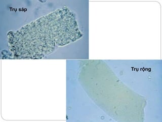 Trụ sáp
Trụ rộng
 