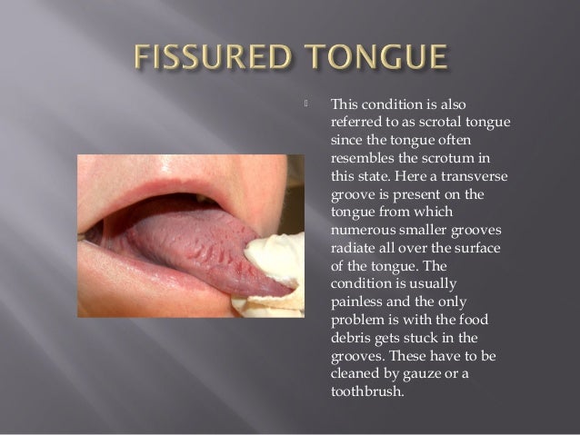 The Tongue