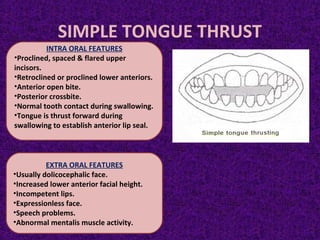 SIMPLE TONGUE THRUST
INTRA ORAL FEATURES
•Proclined, spaced & flared upper
incisors.
•Retroclined or proclined lower anteriors.
•Anterior open bite.
•Posterior crossbite.
•Normal tooth contact during swallowing.
•Tongue is thrust forward during
swallowing to establish anterior lip seal.
EXTRA ORAL FEATURES
•Usually dolicocephalic face.
•Increased lower anterior facial height.
•Incompetent lips.
•Expressionless face.
•Speech problems.
•Abnormal mentalis muscle activity.
 