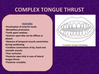 COMPLEX TONGUE THRUST
FEATURES
•Proclination of anterior teeth.
•Bimaxillary protrusion.
•Teeth apart swallow.
•Anterior open bite can be diffuse or
absent.
•Absence of temporal muscle constriction
during swallowing.
•Combine contractions of lip, facial and
mentalis muscle.
•Poor occlusion.
•Posterior open bite in case of lateral
tongue thrust.
•Posterior crossbite.
 