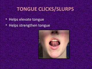 TONGUE CLICKS/SLURPS
• Helps elevate tongue
• Helps strengthen tongue
 