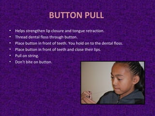 BUTTON PULL
• Helps strengthen lip closure and tongue retraction.
• Thread dental floss through button.
• Place button in front of teeth. You hold on to the dental floss.
• Place button in front of teeth and close their lips.
• Pull on string.
• Don’t bite on button.
 