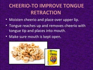 CHEERIO-TO IMPROVE TONGUE
RETRACTION
• Moisten cheerio and place over upper lip.
• Tongue reaches up and removes cheerio with
tongue tip and places into mouth.
• Make sure mouth is kept open.
 
