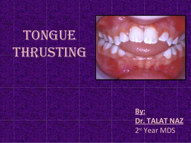 Tongue Thrusting Dr Talat Naz