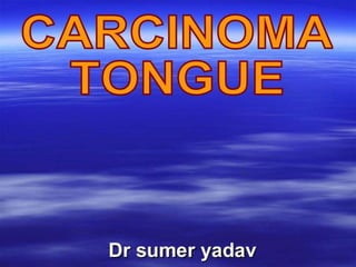 tongue-carcinoma.pptx