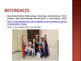  Illustrated Dental Embryology, Histology, and Anatomy, Third
Edition. Mary Bath-Balogh and Margaret J. Fehrenbach. 2010
 http://www.webmd.com/skin-problems-and-treatments/picture-
of-geographic-tongue
 http://www.mayoclinic.com/health/
 