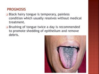 PROGNOSIS
 Black hairy tongue is temporary, painless
condition which usually resolves without medical
treatment.
 Brushing of tongue twice a day is recommended
to promote shedding of epithelium and remove
debris.
 
