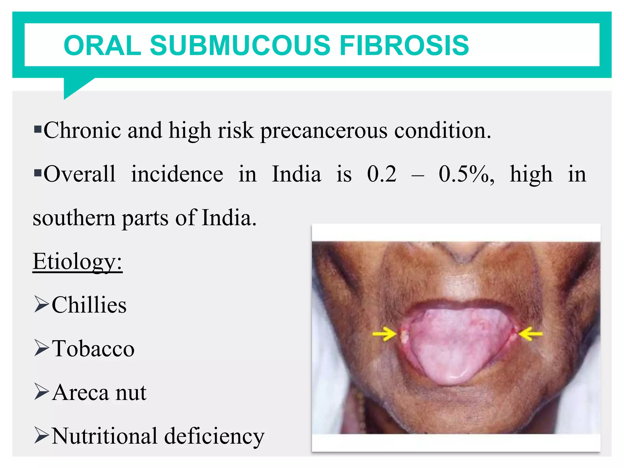 ORAL SUBMUCOUS FIBROSIS
Chronic and high risk precancerous condition.
Overall incidence in India is 0.2 – 0.5%, high in
southern parts of India.
Etiology:
Chillies
Tobacco
Areca nut
Nutritional deficiency
 