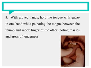 3. With gloved hands, hold the tongue with gauze
in one hand while palpating the tongue between the
thumb and index finger of the other, noting masses
and areas of tenderness
 