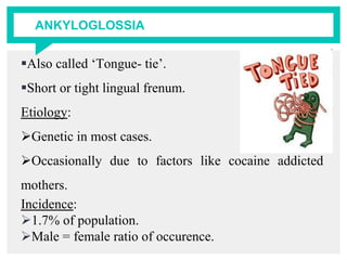 ANKYLOGLOSSIA
Also called ‘Tongue- tie’.
Short or tight lingual frenum.
Etiology:
Genetic in most cases.
Occasionally due to factors like cocaine addicted
mothers.
Incidence:
1.7% of population.
Male = female ratio of occurence.
 
