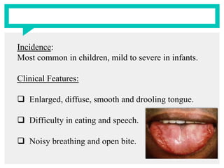Incidence:
Most common in children, mild to severe in infants.
Clinical Features:
 Enlarged, diffuse, smooth and drooling tongue.
 Difficulty in eating and speech.
 Noisy breathing and open bite.
 
