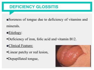 DEFICIENCY GLOSSITIS
■Soreness of tongue due to deficiency of vitamins and
minerals.
■Etiology:
Deficiency of iron, folic acid and vitamin B12.
■Clinical Feature:
Linear patchy or red lesion,
Depapillated tongue,
 