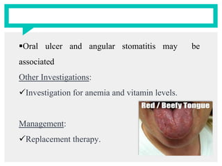 Oral ulcer and angular stomatitis may be
associated
Other Investigations:
Investigation for anemia and vitamin levels.
Management:
Replacement therapy.
 