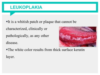 LEUKOPLAKIA
It is a whitish patch or plaque that cannot be
characterized, clinically or
pathologically, as any other
disease.
The white color results from thick surface keratin
layer.
 