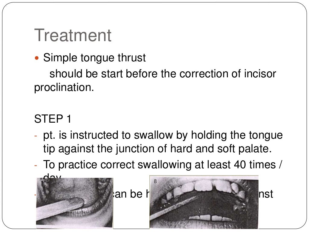 Tongue and malocclusion by DR. GAURAV VARMA . MDS