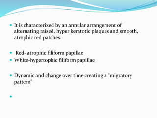  It is characterized by an annular arrangement of
alternating raised, hyper keratotic plaques and smooth,
atrophic red patches.
 Red- atrophic filiform papillae
 White-hypertophic filiform papillae
 Dynamic and change over time creating a “migratory
pattern”

 