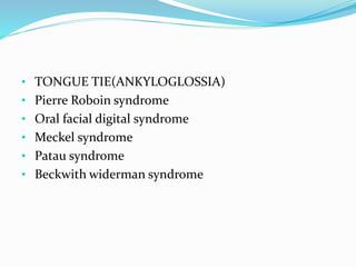 • TONGUE TIE(ANKYLOGLOSSIA)
• Pierre Roboin syndrome
• Oral facial digital syndrome
• Meckel syndrome
• Patau syndrome
• Beckwith widerman syndrome
 