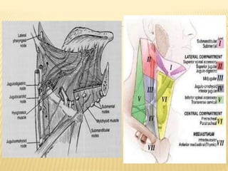 Tongue cancer | PPTX