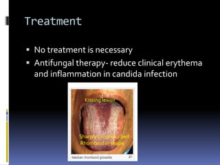 Treatment
 No treatment is necessary
 Antifungal therapy- reduce clinical erythema
and inflammation in candida infection
Kissing lesion
Sharply circumscribed
Rhomboid in shape
 