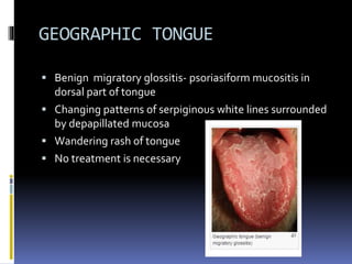 Tongue disorders | PPT