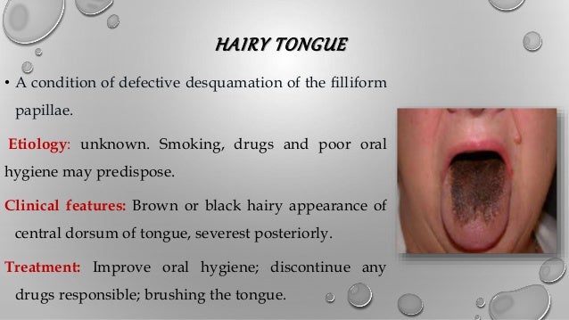 development & growth of tongue