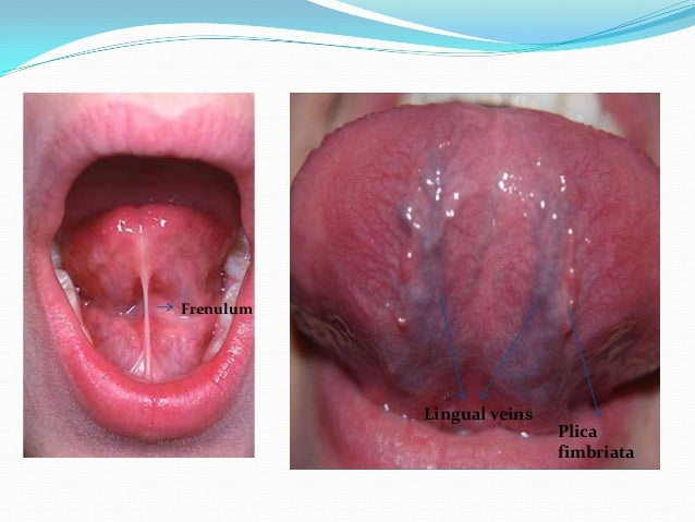 Anatomy of Tongue