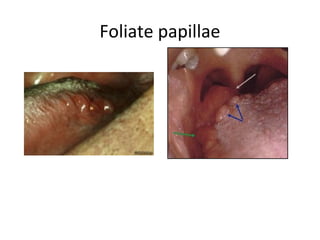 Foliate papillae
 