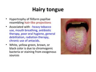 Hairy tongue
• Hypertrophy of filiform papillae
resembling hair-like projections
• Associated with - heavy tobacco
use, mouth breathing, antibiotic
therapy, poor oral hygiene, general
debilitation, radiation therapy,
chronic use of antacids.
• White, yellow green, brown, or
black color is due to chromogenic
bacteria or staining from exogenous
sources
 