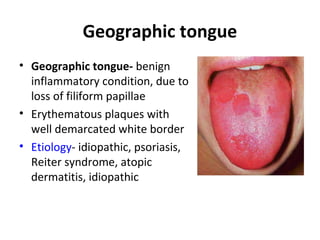 Geographic tongue
• Geographic tongue- benign
inflammatory condition, due to
loss of filiform papillae
• Erythematous plaques with
well demarcated white border
• Etiology- idiopathic, psoriasis,
Reiter syndrome, atopic
dermatitis, idiopathic
 