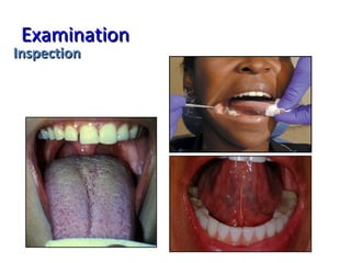 ExaminationExamination
InspectionInspection
 