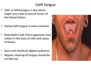 • cleft or bifid tongue is rare which
might occur due to lack of fusion of
the lateral halves.
• Partial cleft tongue is more common
• Food debris and micro organisms may
collect in the base of cleft and cause
irritation.
• Seen with Orofacial digital syndrome
• Regular cleaning of tongue should be
carried out.
Cleft tongue
 