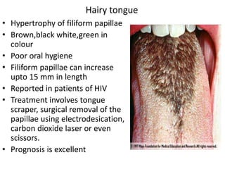 • Hypertrophy of filiform papillae
• Brown,black white,green in
colour
• Poor oral hygiene
• Filiform papillae can increase
upto 15 mm in length
• Reported in patients of HIV
• Treatment involves tongue
scraper, surgical removal of the
papillae using electrodesication,
carbon dioxide laser or even
scissors.
• Prognosis is excellent
Hairy tongue
 