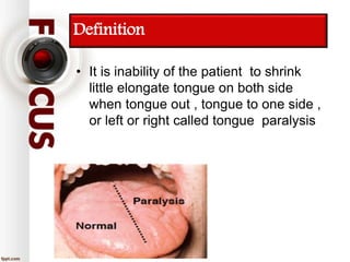 Definition
• It is inability of the patient to shrink
little elongate tongue on both side
when tongue out , tongue to one side ,
or left or right called tongue paralysis
 