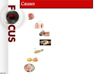 Causes
 