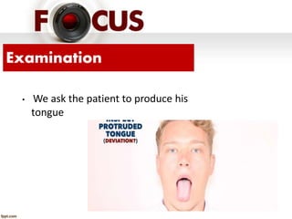 Company Logo
Examination
• We ask the patient to produce his
tongue
 