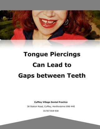 Tongue Piercings
Can Lead to
Gaps between Teeth
Cuffley Village Dental Practice
38 Station Road, Cuffley, Hertfordshire EN6 4HE
01707 818 938
 