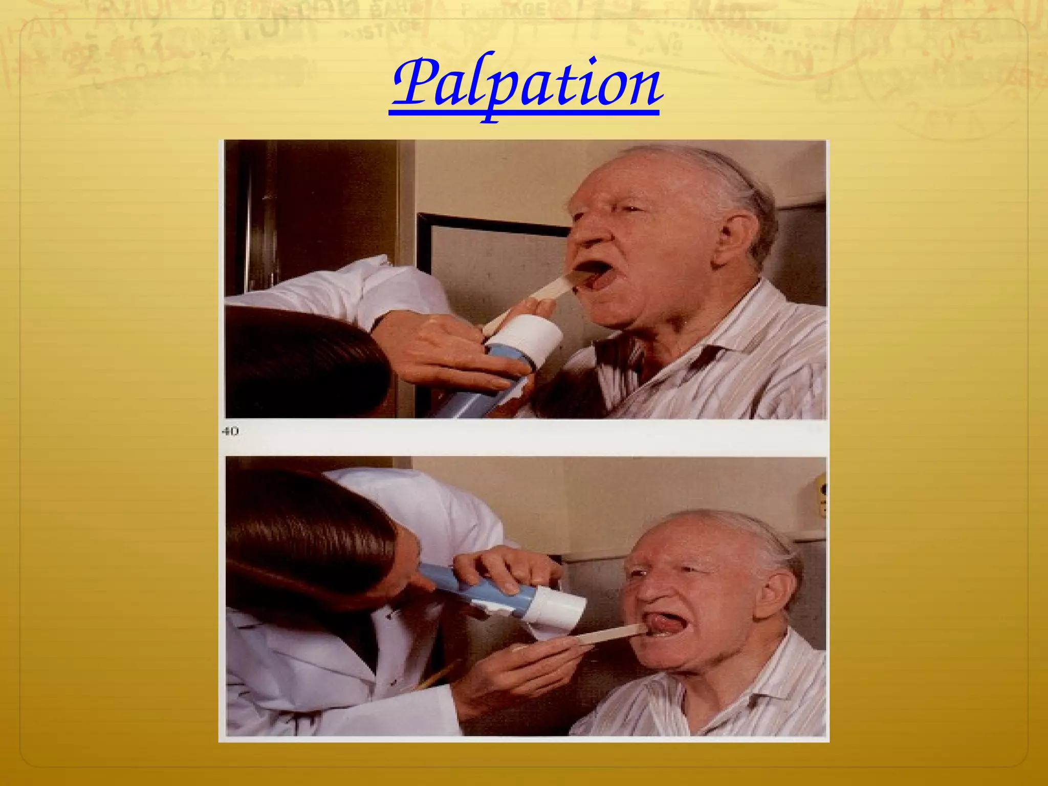 Palpation
 